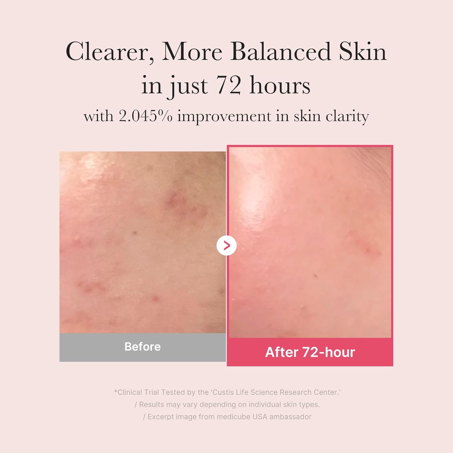 Medicube TXA Niacinamide 15% Serum - Image 3