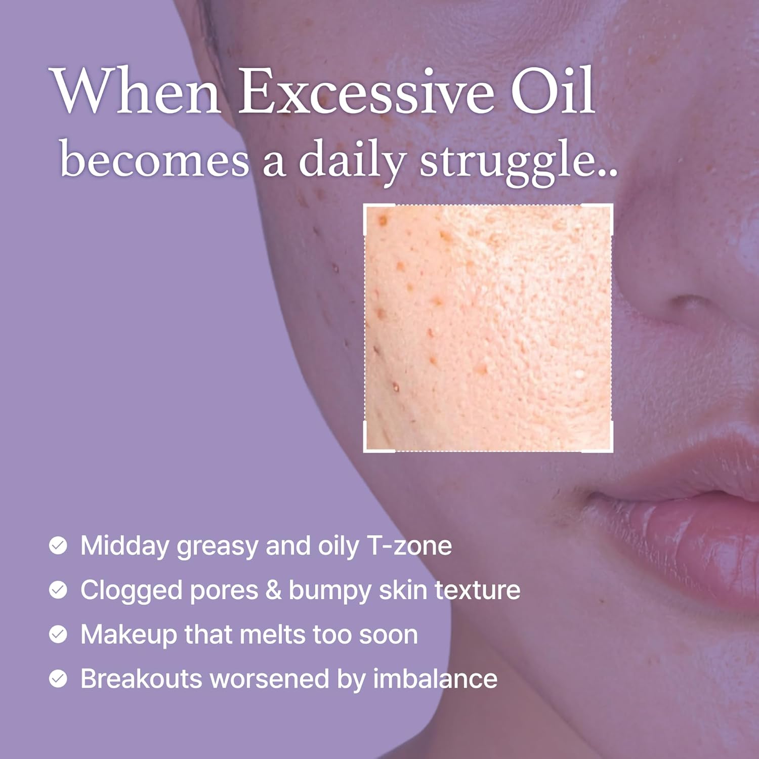 I’M FROM Black Rice Toner Mini 30ml - Image 7