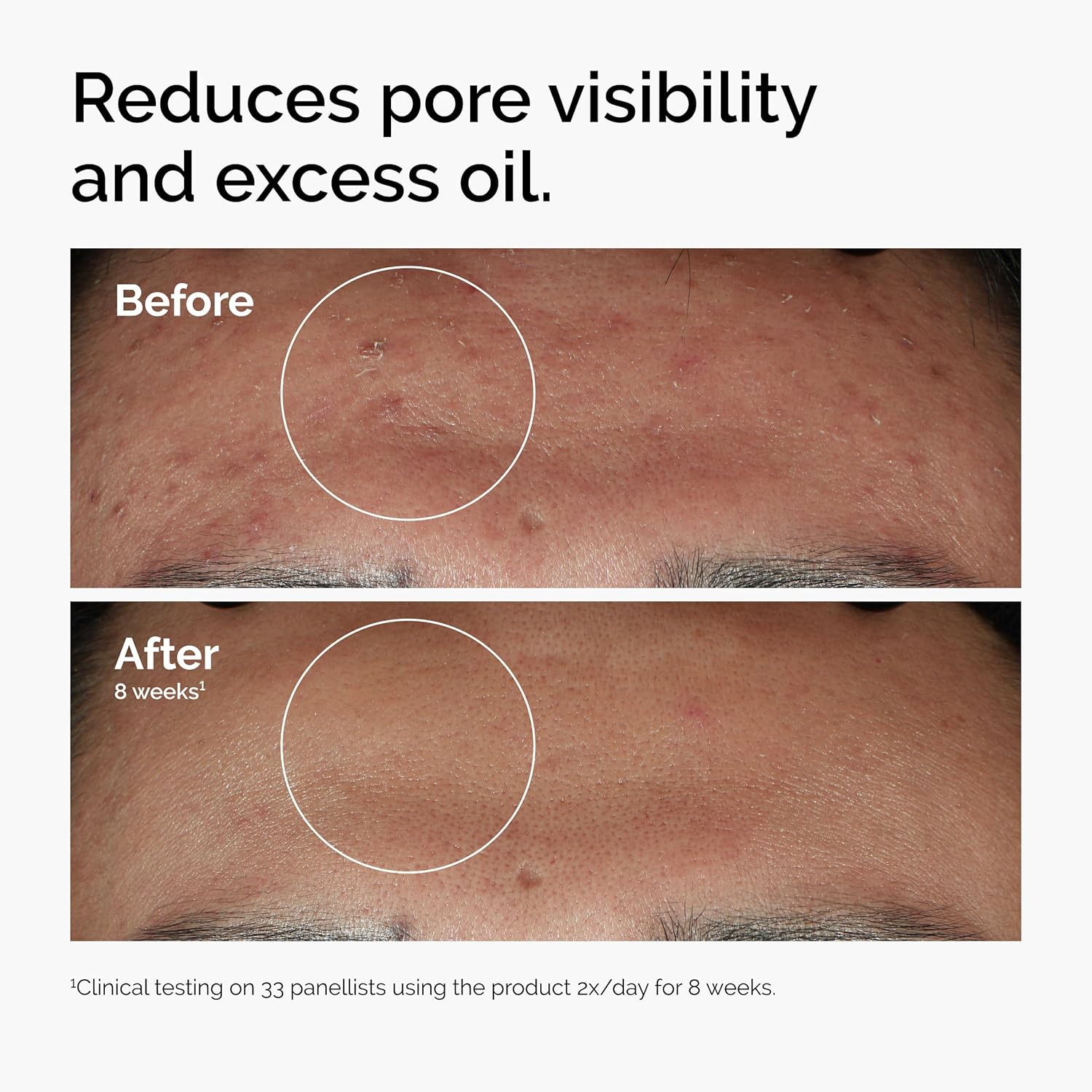 The Ordinary Niacinamide 10% + Zinc1% (30ml) - Image 4