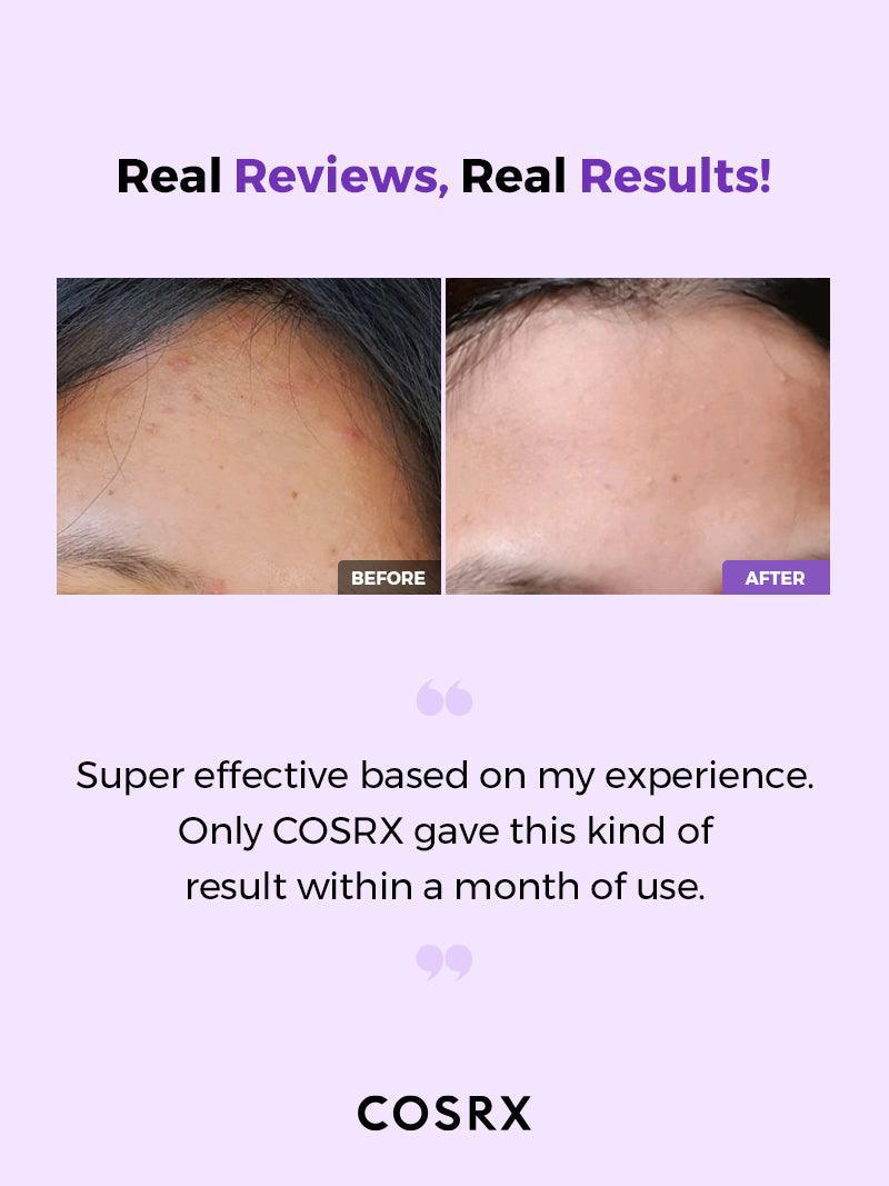 COSRX AHA/BHA Clarifying Treatment Toner 150ml - Image 3